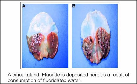 pineal gland